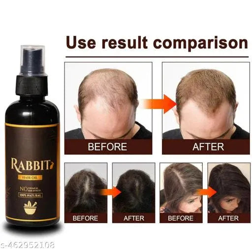 Garuda Rabbit Herbal Hair Oil(5.0 ⭐⭐⭐⭐⭐ 18,345 REVIEWS) Globally