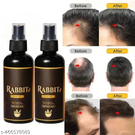 Garuda Rabbit Herbal Hair Oil(5.0 ⭐⭐⭐⭐⭐ 18,345 REVIEWS) Globally